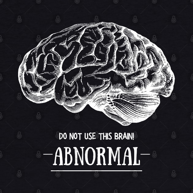 Young Frankenstein Abnormal Brain: White by Print Lilac